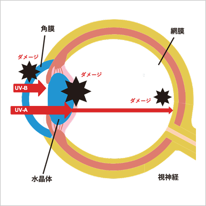 目へのダメージ イメージ図